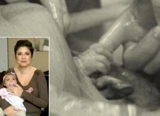 Unikal mənzərə: anasının qarnından həkim ilə görüşdü
